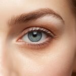 Close-up photo of the under-eye area showing the tear trough region and natural skin texture