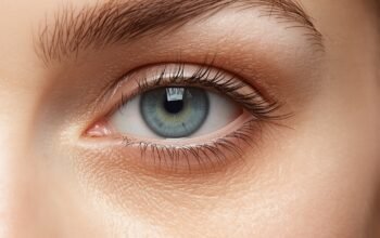 Close-up photo of the under-eye area showing the tear trough region and natural skin texture